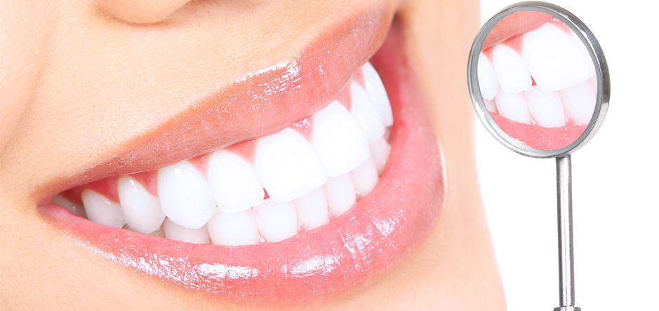 Teeth Whitening