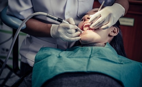 Wisdom Tooth Cavity Removal